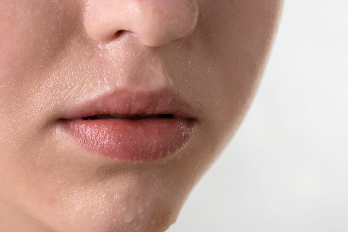 Herpes labial por estrés: ¿Cómo identificarlo y qué lo desencadena?