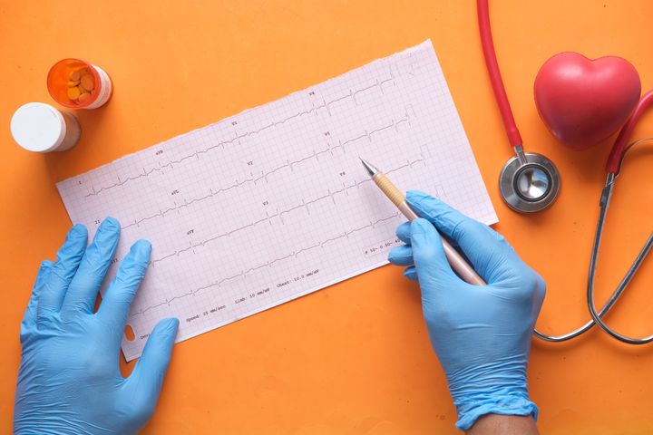 ¿Examen de electrocardiograma a domicilio? Examedi lo tiene 😎