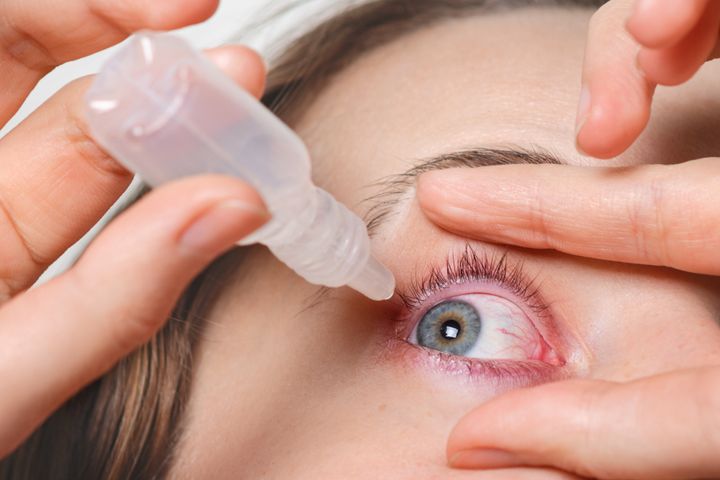 Conjuntivitis: ¿Cuáles son sus síntomas y cómo prevenir su contagio?